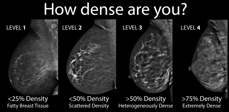 As seen above, a chart with detailed information on breasts' density levels. Image Credit: Nature