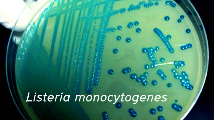 The L. monocytogenes is the major human pathogen of the genus and is usually the bacteria that causes listeriosis. Photo credit: Youtube