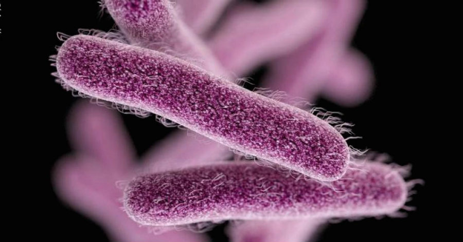 Health officials have reported dozens of Shigellosis cases among city residents. Photo credit: Shigella Blog