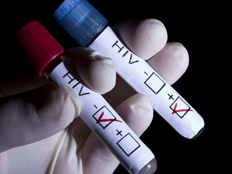 hiv-tests