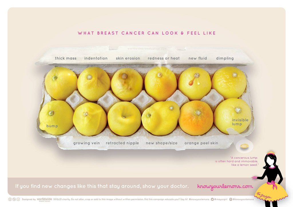 "What breast cancer can look and feel like"