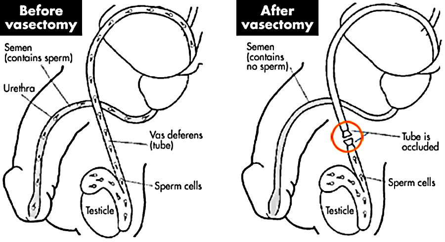 Image credit: Male Contraception Information Project