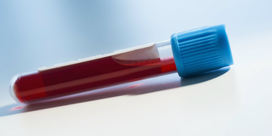 CancerLocator will be able to detect cancerous DNA through a blood sample. Image credit: Huffpost Living Canada