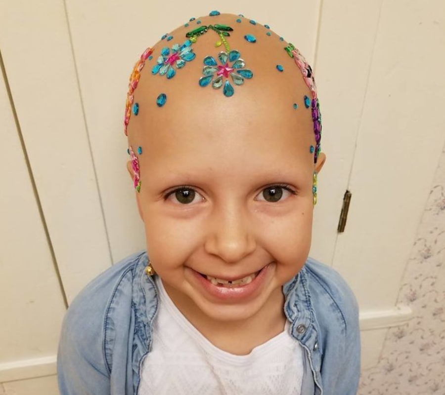 A 7 Year Old Girl With Alopecia Wins Crazy Hair Day Competition