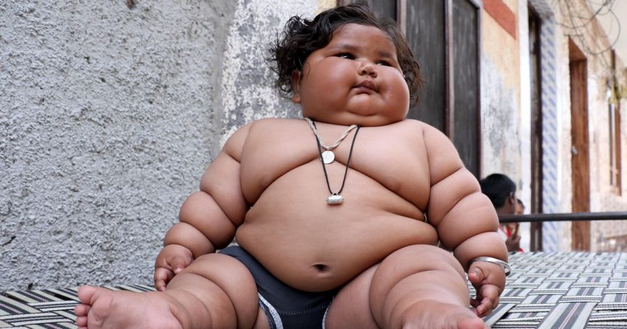 Morbidly obese baby girl born in India