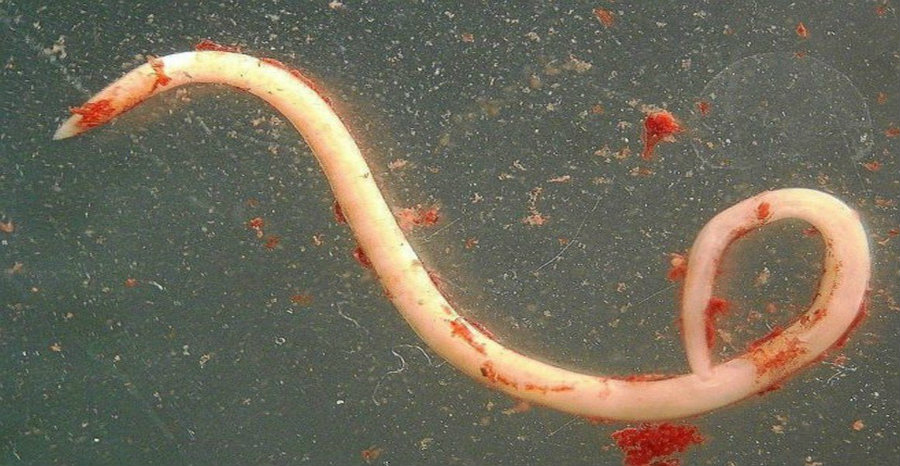 Anisakiasis parasite. Image credit: Mediderman.com