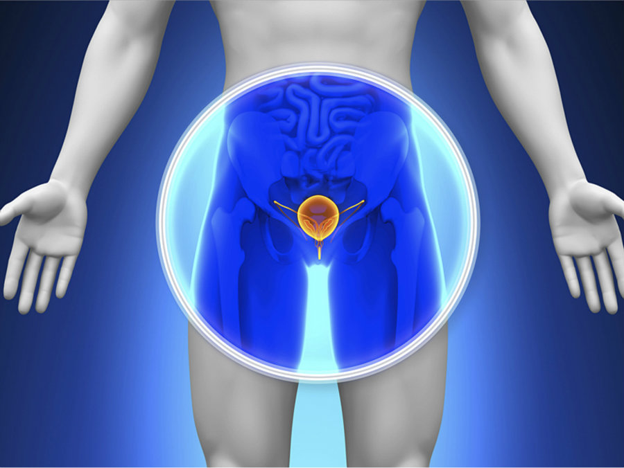 Abiraterone is usually given to men with advanced prostate cancer that has spread and has stopped responding to hormone therapy. Image credit: Medical Herald