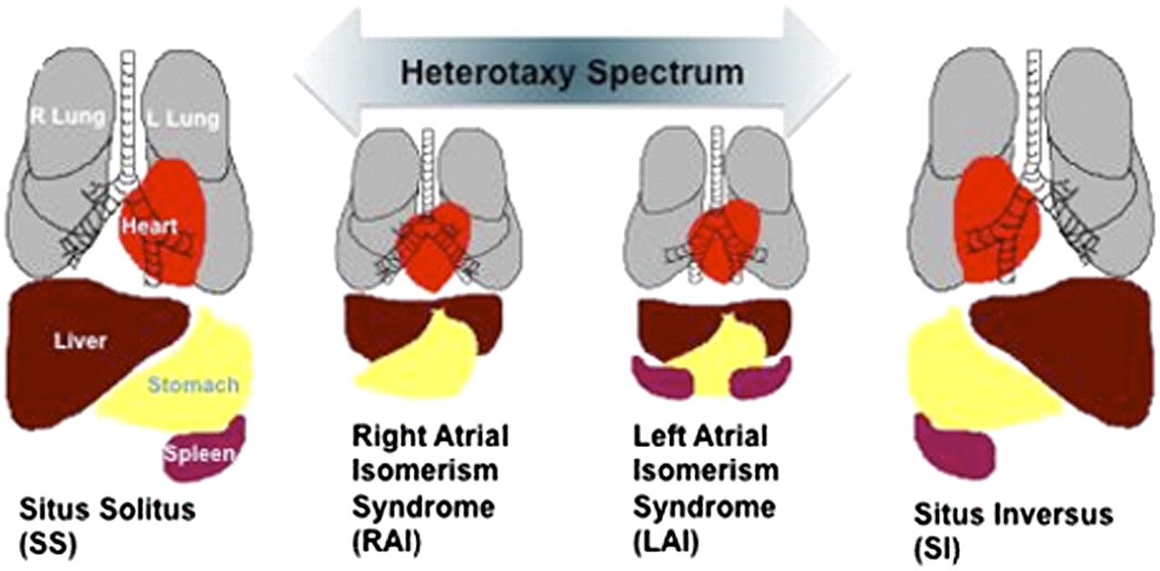 Image credit: Biologicalexceptions.blogspot.com