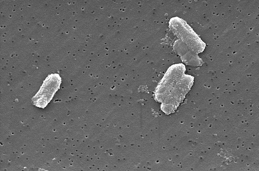 Vibrio vulnificus or Citrobacter  freundii. Image Credit: CDC