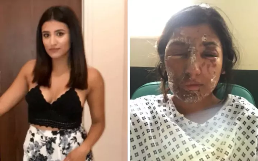 Resham Khan, attacked with acid the day she turned 21. Image Credit: GoFundMe / Telegraph.co.uk