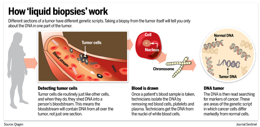 Infographic explaining how liquid biopsies work. Image Credit: Qiagen / Journal Sentinel.