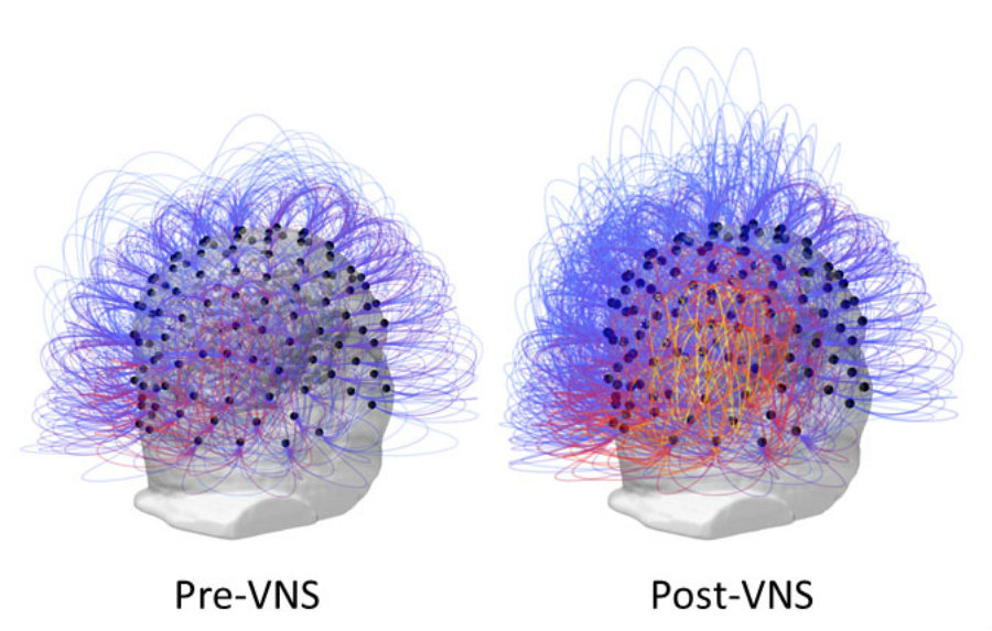 Image credit: Ars Technica