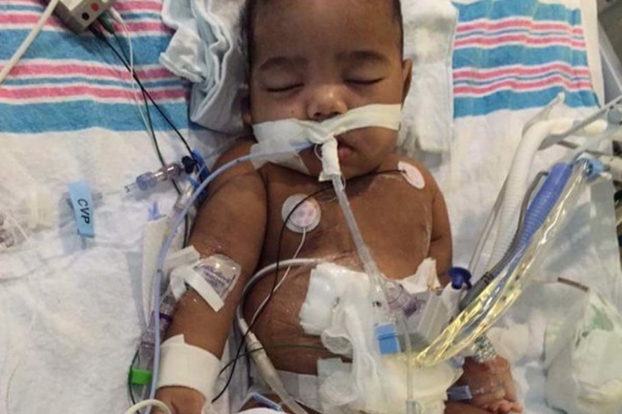 Kidney transplant delayed for 2-year-old, Atlanta 2-year-old kidney transplant