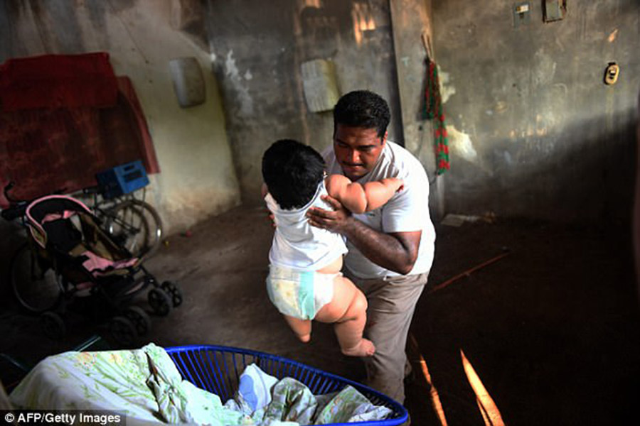 Mexican overweight baby, Luis Gonzales, Prader-Willi Syndrome