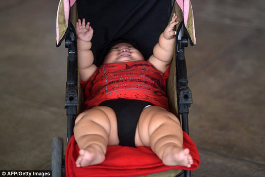 Mexican overweight baby, Luis Gonzales, Prader-Willi Syndrome