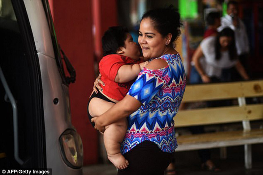 Mexican overweight baby, Luis Gonzales, Prader-Willi Syndrome