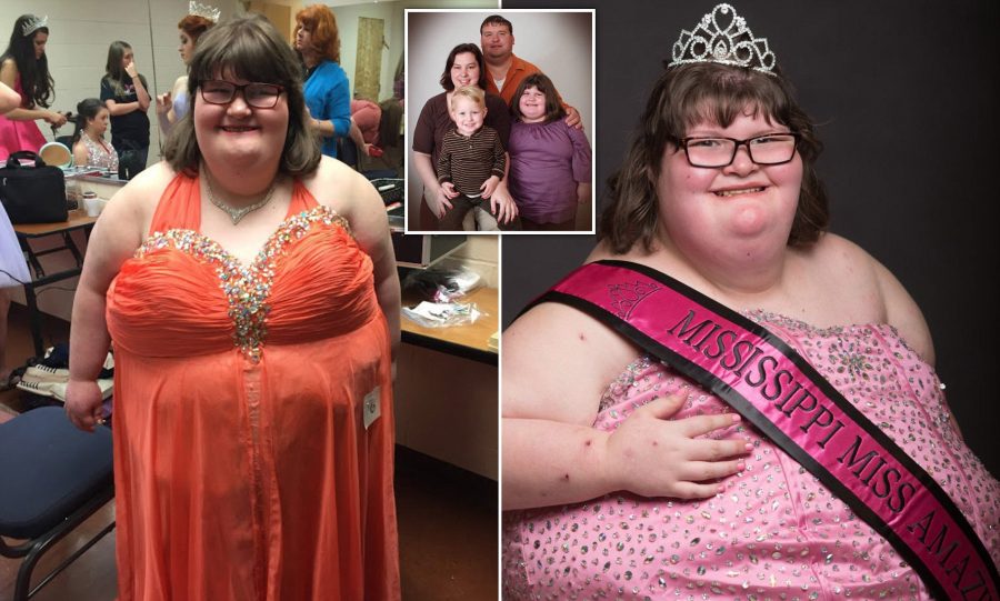 Prader–Willi syndrome, pageant