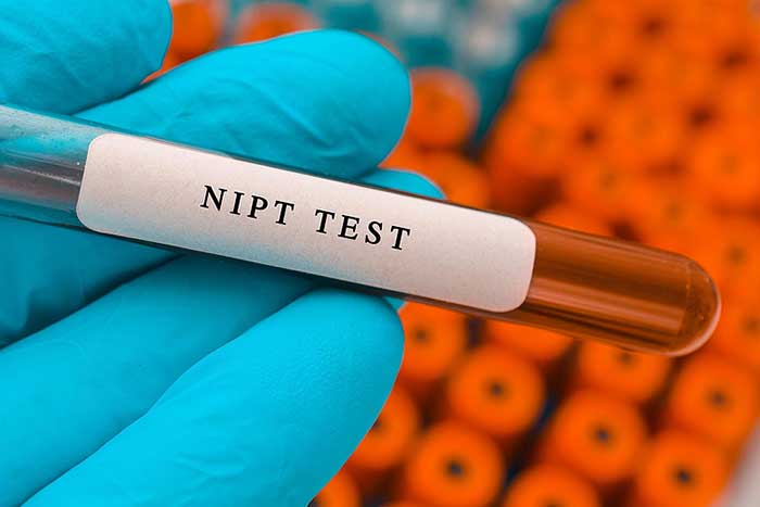 When is the Right Time for NIPT?