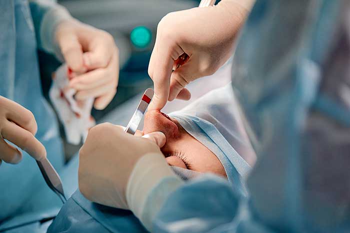 What's Involved During a Rhinoplasty Procedure?